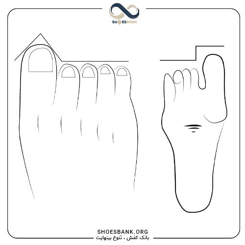 مدل پای آلمانی